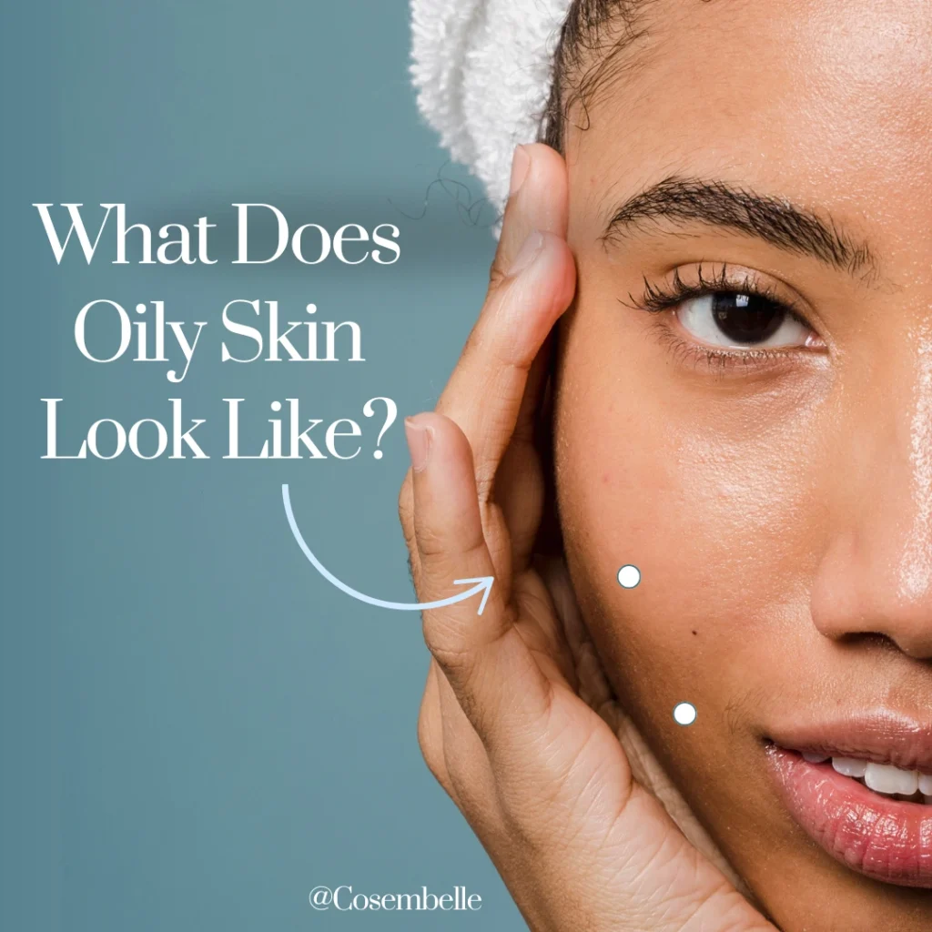 What does oily skin look like? Discover the signs of oily skin and effective skincare solutions.